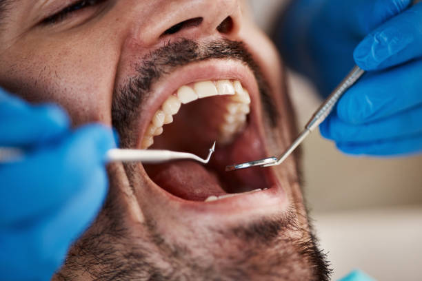 Best Broken or Chipped Tooth Repair in Black Forest, CO